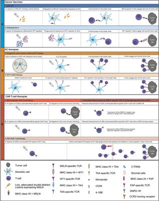 Cellular Immunotherapy and Locoregional Administration of CAR T-Cells in Malignant Pleural Mesothelioma